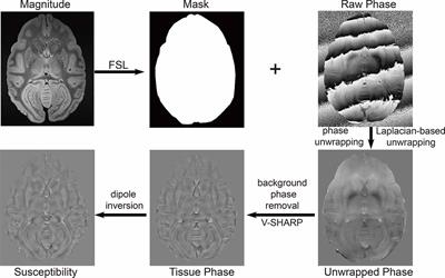 Ultra-High-Resolution in vitro MRI Study of Age-Related Brain Subcortical Susceptibility Alteration in Rhesus Monkeys at 9.4 T